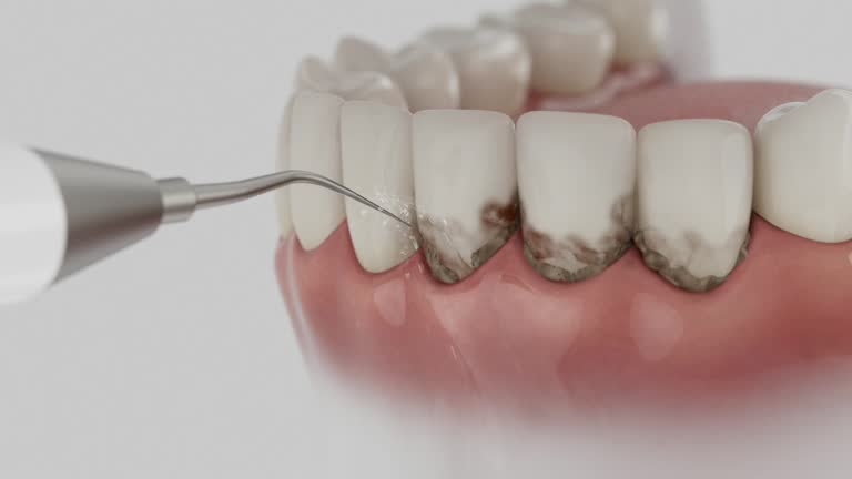 Reliable Dental contractor in Monroe City, MO by Dentist Open Now